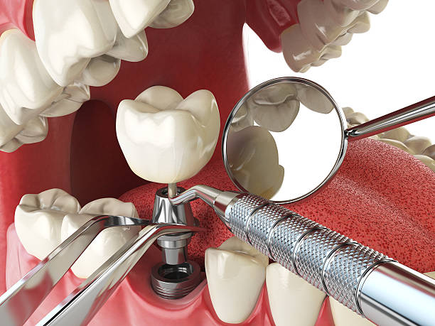 Best Mobile Emergency Dentist in Humboldt Hill, CA